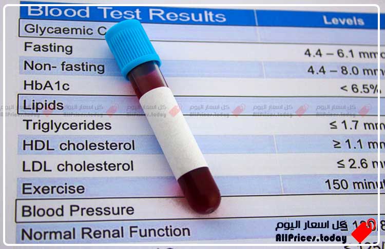 سعر تحليل الدهون الثلاثية في معمل المختبر